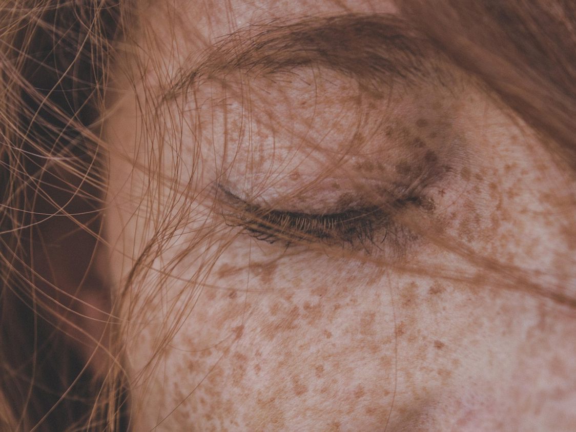 Kvinna med fräknar och slutet öga, närbild av ansikte och hår.